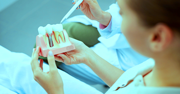 имплантация зубов подготовка